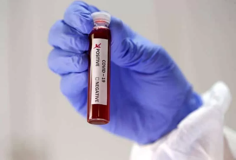 Generic Malaria, Hypertension Medicines being Tested in Race in the US to find COVID-19 Cure