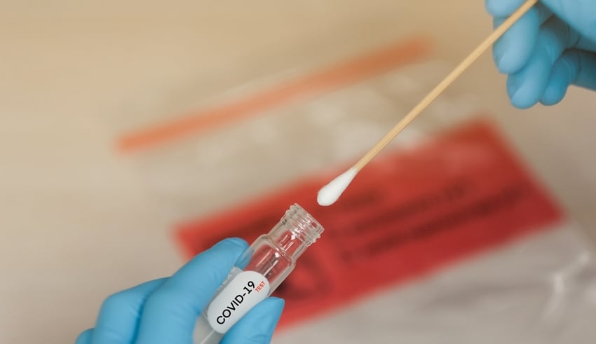 COVID-19 Nasal swab laboratory test in hospital lab