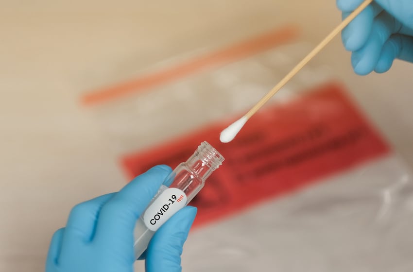 COVID-19 Nasal swab laboratory test in hospital lab