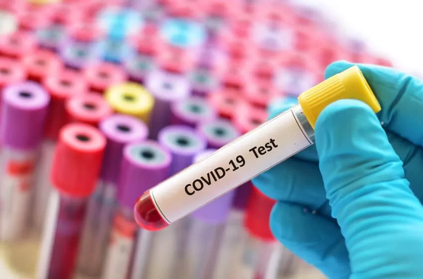 Current Rules: Malaysians Will Need to Pay RM30-RM150 for the COVID-19 Test When They Return Abroad