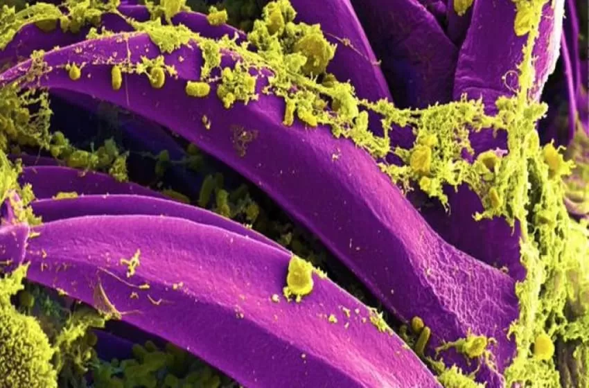 In the Midst of Pandemic: There’s a Suspected Bubonic Plague found in West Mongolia