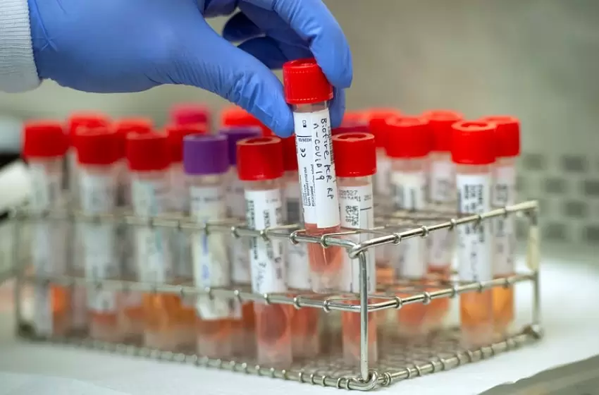 MOH: Malaysia to wait for Russia, China’s clinical trial results on vaccines