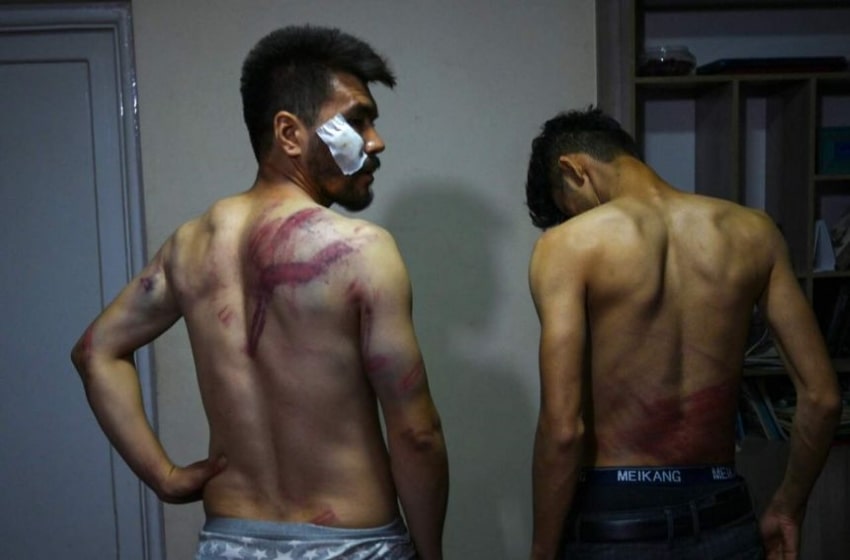 Afghan journalists beaten by the Taliban