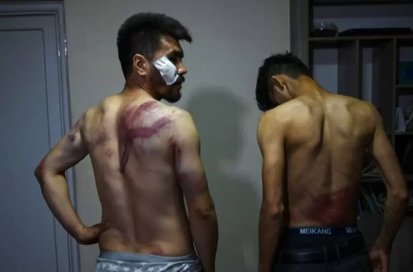 Afghan journalists beaten by the Taliban