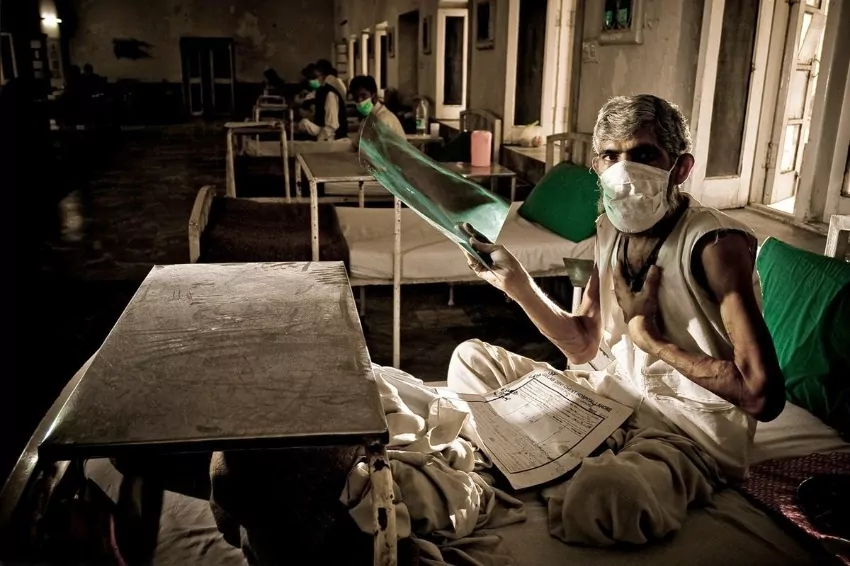 Mandatory tuberculosis screening in Jalan Bukit Merah after 170 people tests positive