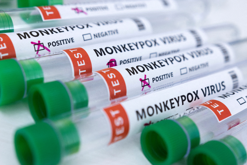 Philippines confirms first monkeypox case, tracks 10 contacts