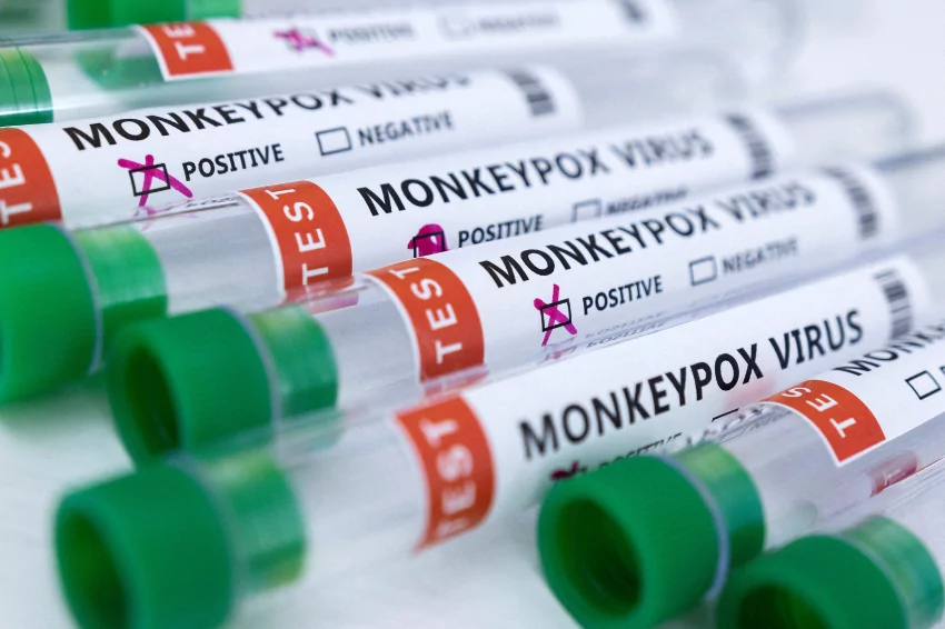 Philippines confirms first monkeypox case, tracks 10 contacts