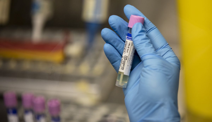 Singapore confirms two more monkeypox cases