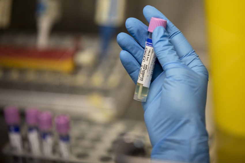 Singapore confirms two more monkeypox cases