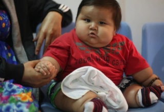 obesity in singaporean children worsens, but fat shaming won't help