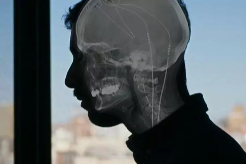 New Study Unlocks Genetic Mysteries of Mental Health