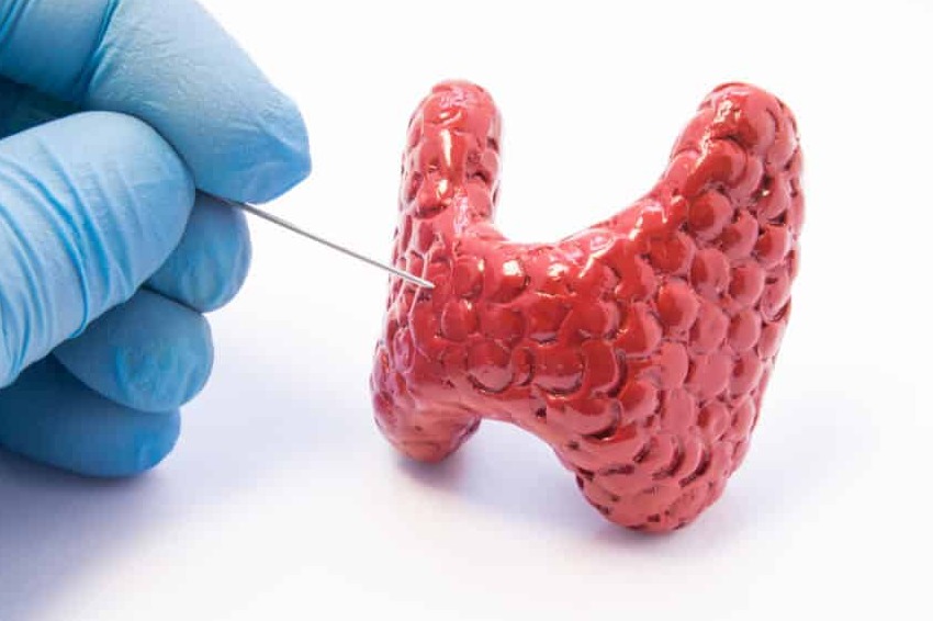 low thyroid cancer awareness among women in makkah region raises concerns