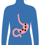 don't let h. pylori take over test and treat to reduce stomach cancer risk