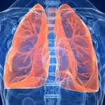 breaking tuberculosis takes over indonesia and here's why