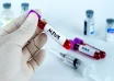 thailand mpox cases